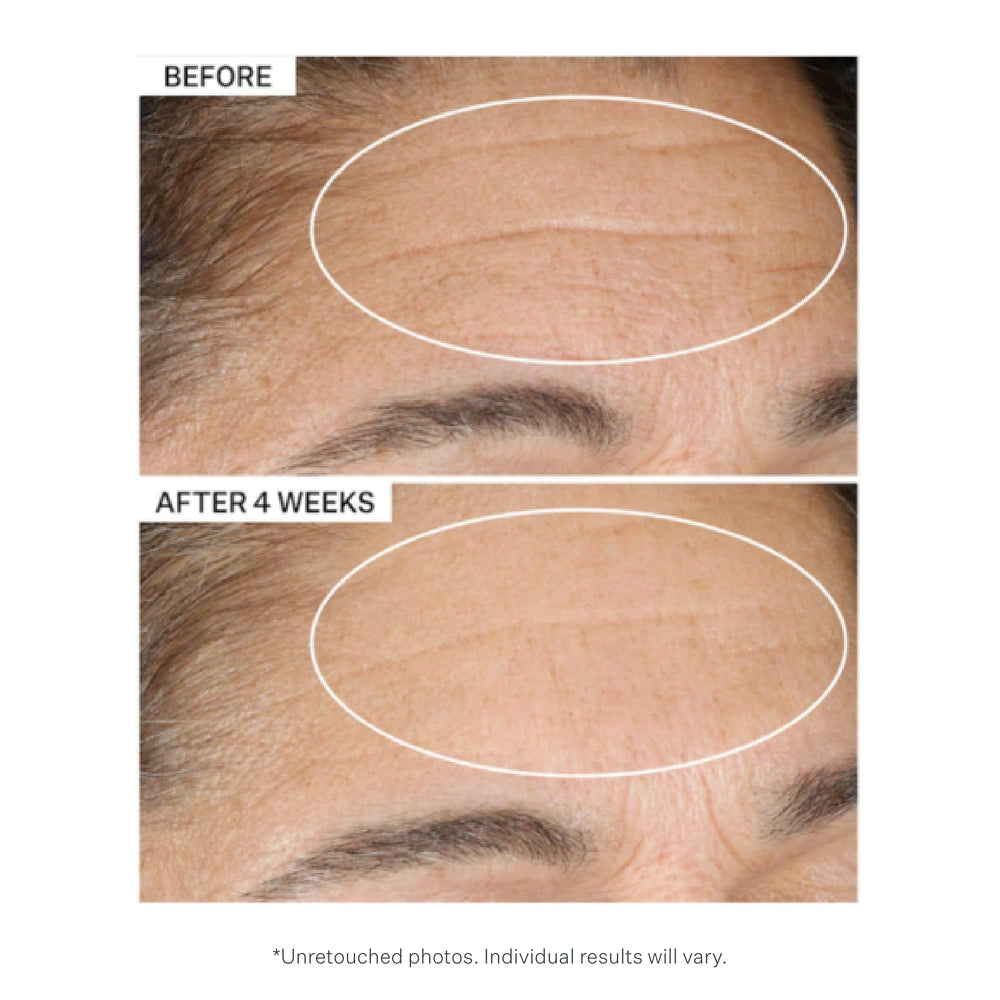 StriVectin ingredients focus on retinol and copper peptides benefit: targets aging signs