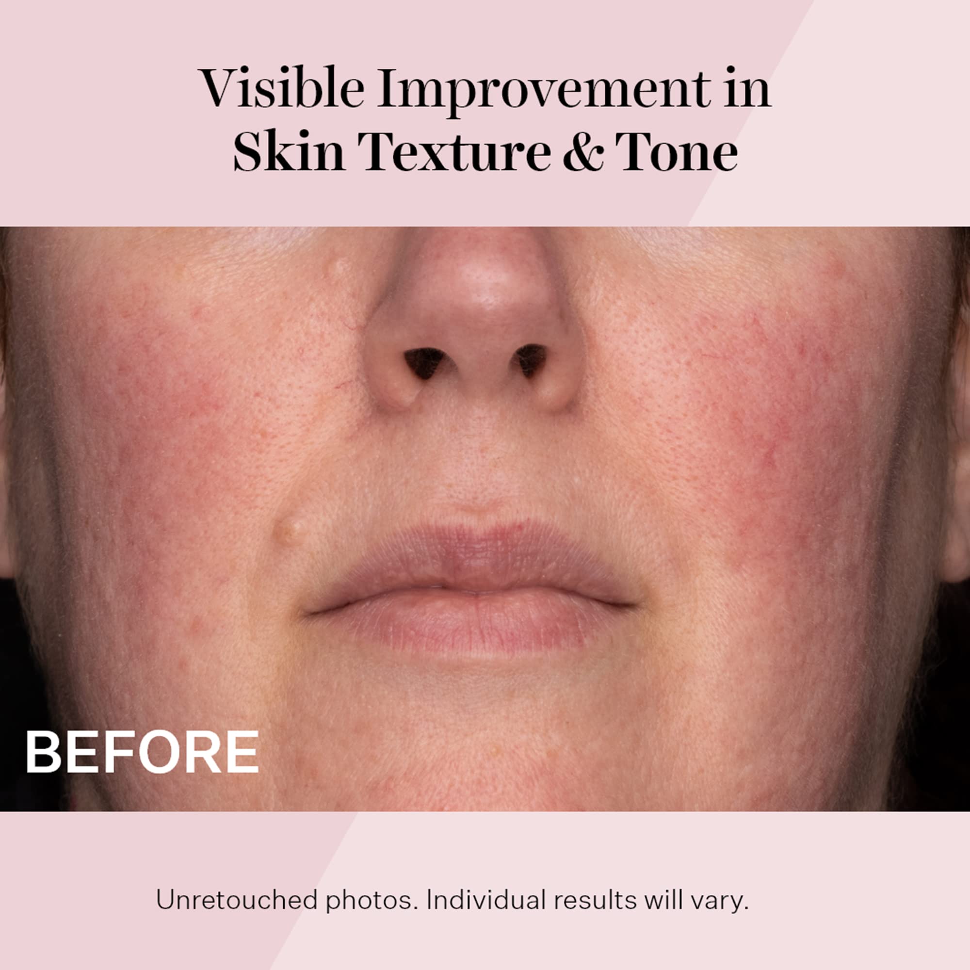 StriVectin ingredients label highlighting NIA-114 and peptides benefits