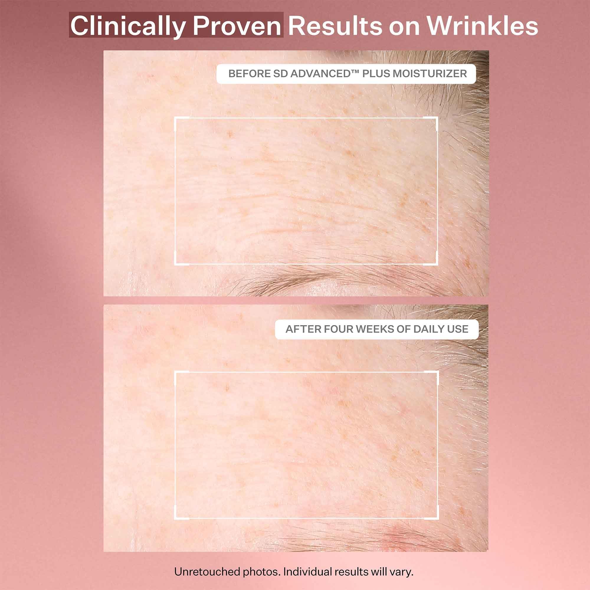 StriVectin on cheek during facial application for fine line smoothing