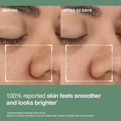 Pad soaked in solution detail displaying StriVectin acid blend benefits for resurfacing