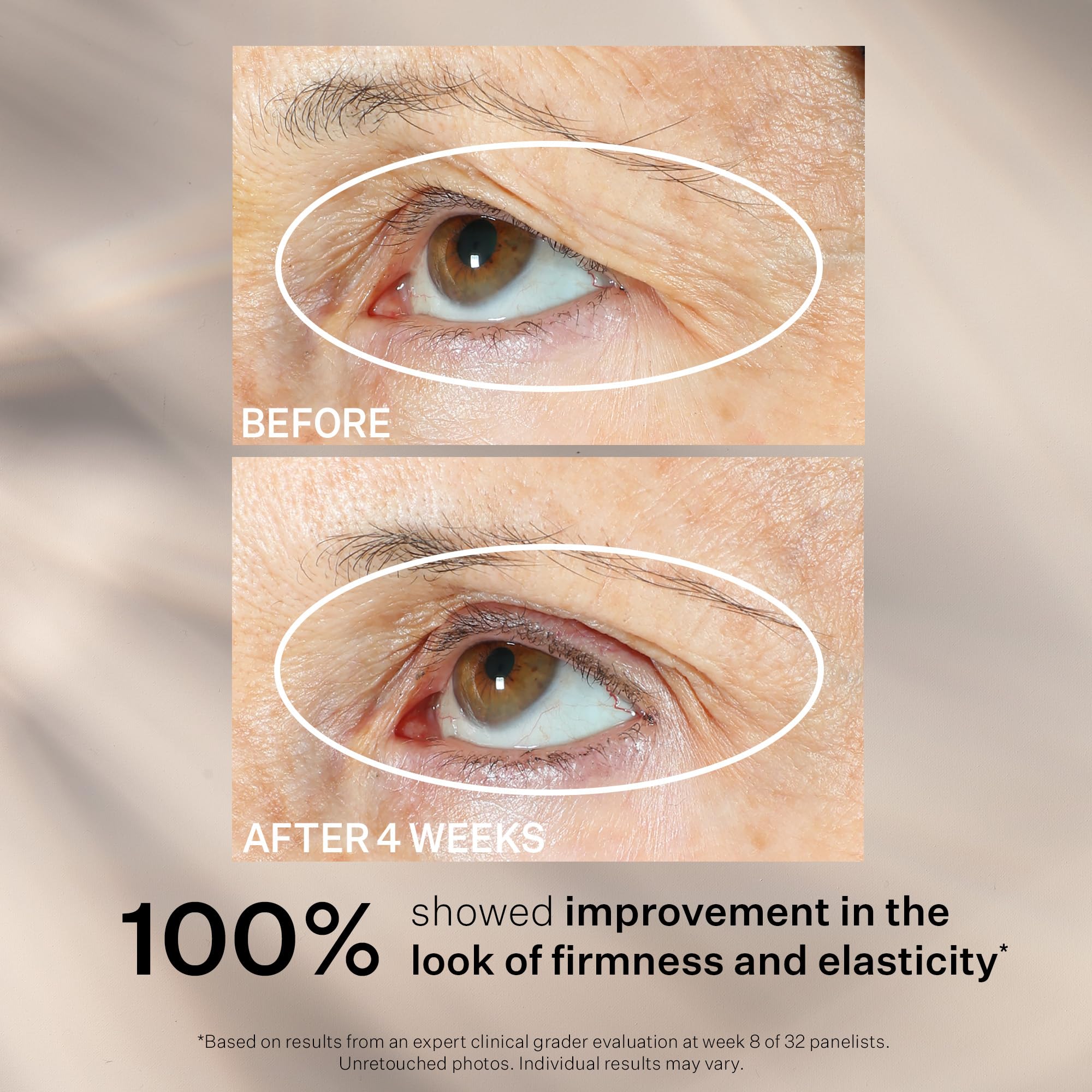 StriVectin smoothing under-eye area, reduces puffiness and brightens appearance