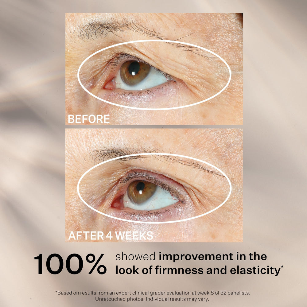 StriVectin smoothing under-eye area, reduces puffiness and brightens appearance