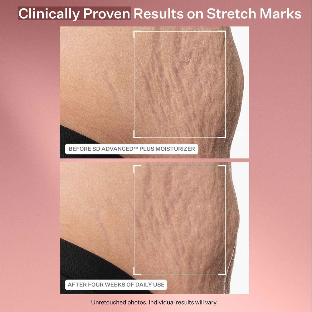 StriVectin serum drop on skin showing fast-absorbing plumping hydration