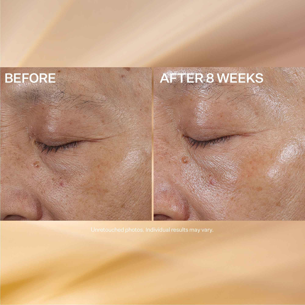 StriVectin ingredient shot with sweet potato root emphasizing corrective action