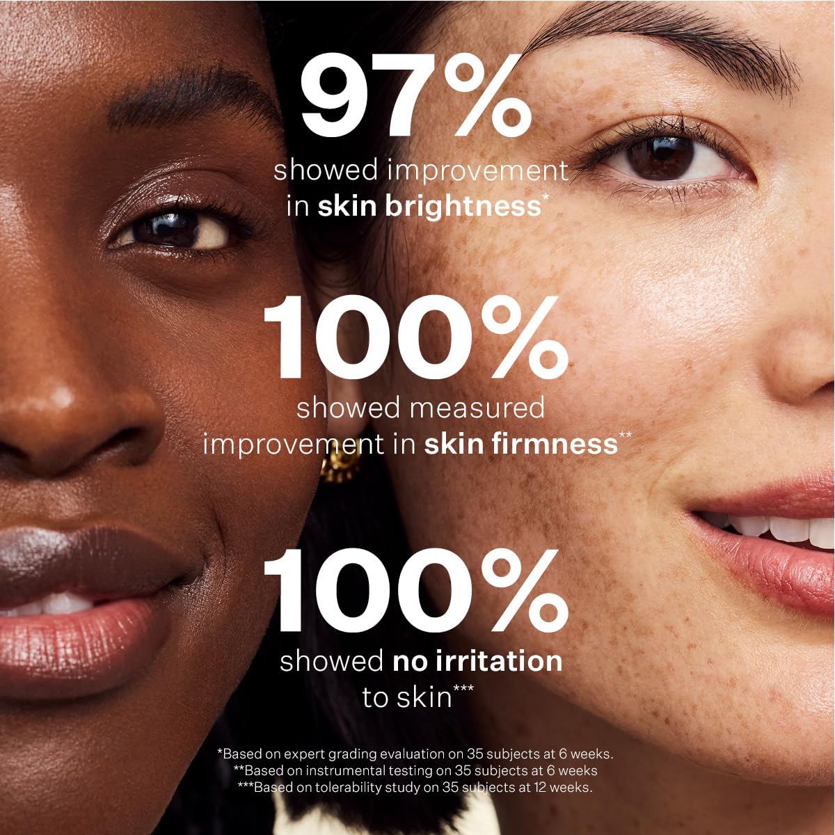 StriVectin used on neck and décolleté for firmer-looking skin