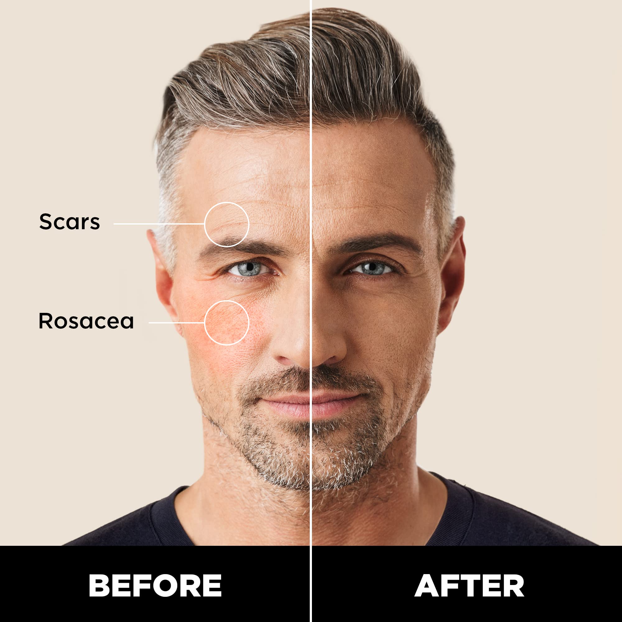 Stryx concealer applied to a cheek demonstrating quick concealment of blemishes