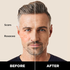 Stryx concealer applied to a cheek demonstrating quick concealment of blemishes