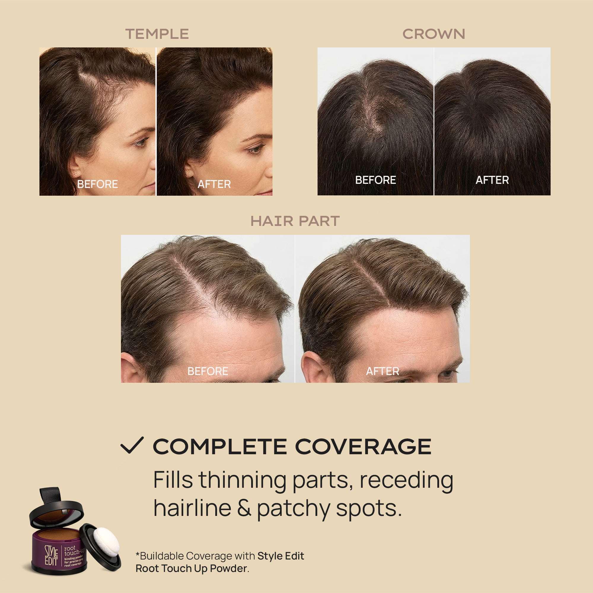 STYLE EDIT before and after crown comparison demonstrating thicker look