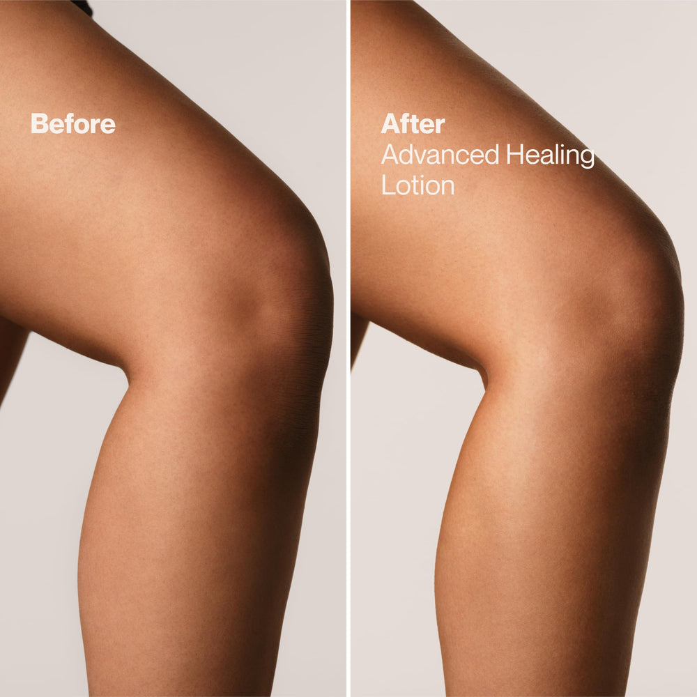 Smooth forearm after using Suave lotion showing visible softness and hydration