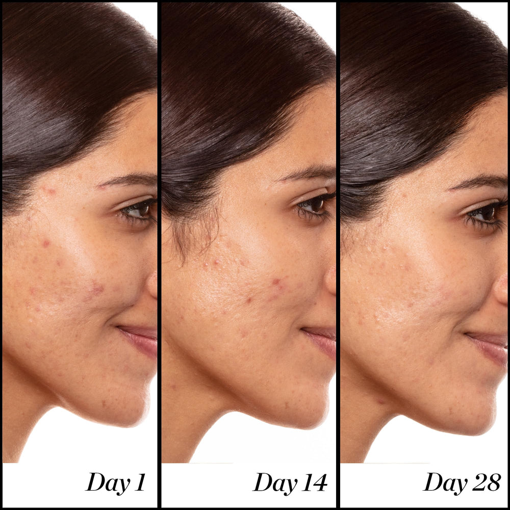 Sunday Riley serum applied to skin, showing immediate lightweight finish and improved skin appearance