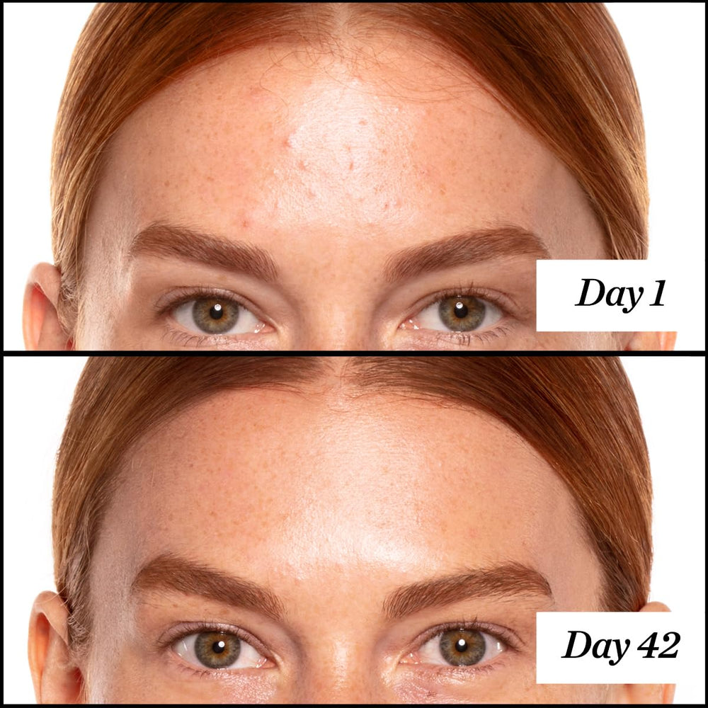 Sunday Riley A+ close-up label listing key actives and benefits like encapsulated retinol and CoQ10