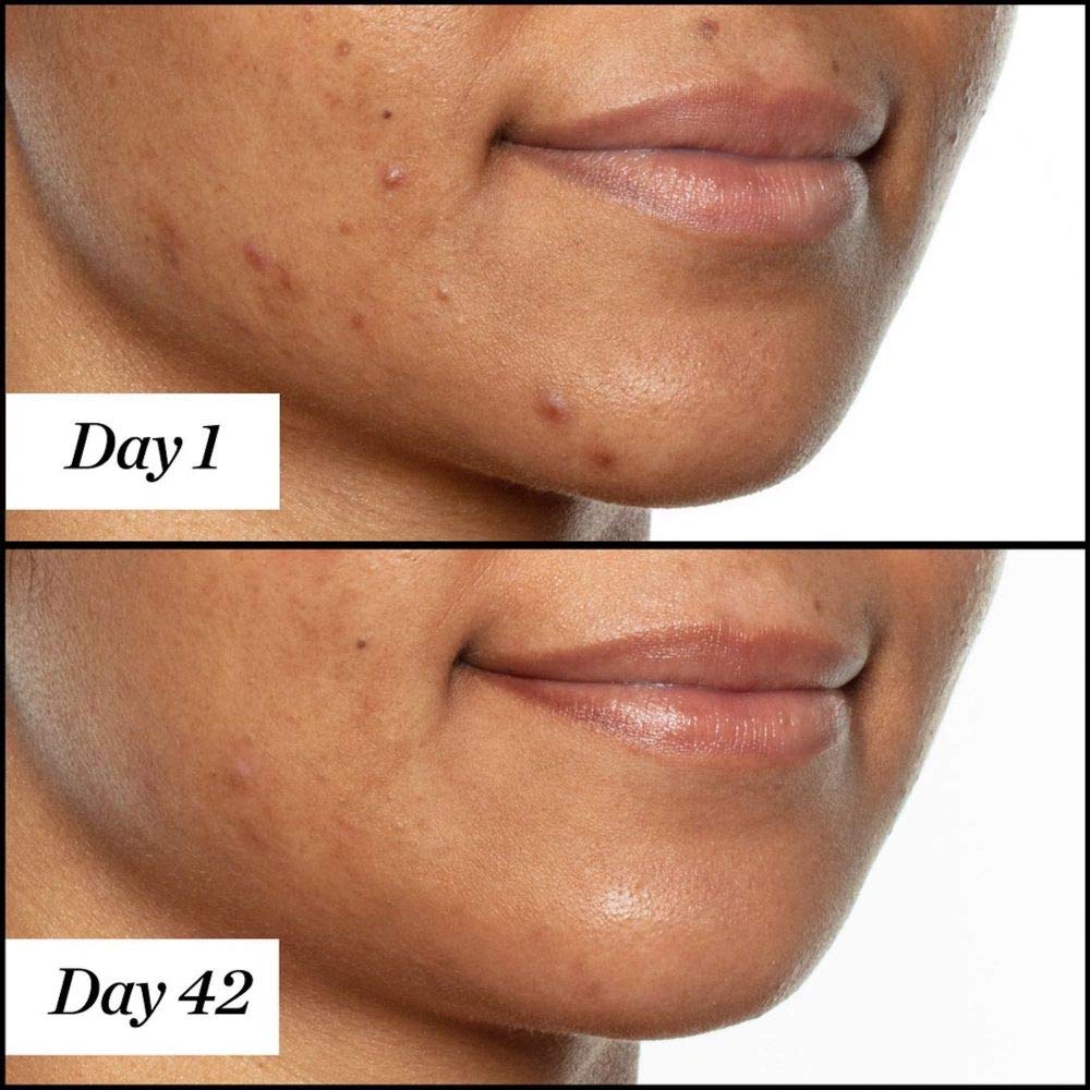 Sunday Riley U.F.O. included in a nighttime routine setting illustrating evening use and layering