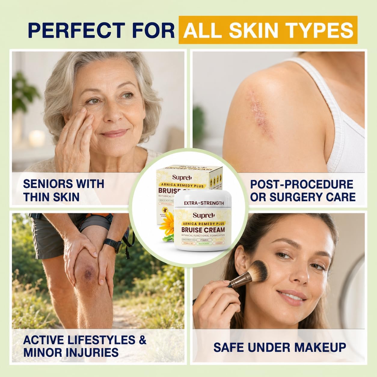 SupreH being applied to a hand to soothe a bruise