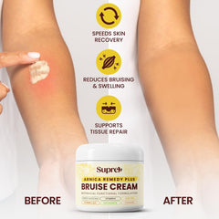 SupreH used on cheek under makeup for subtle coverage