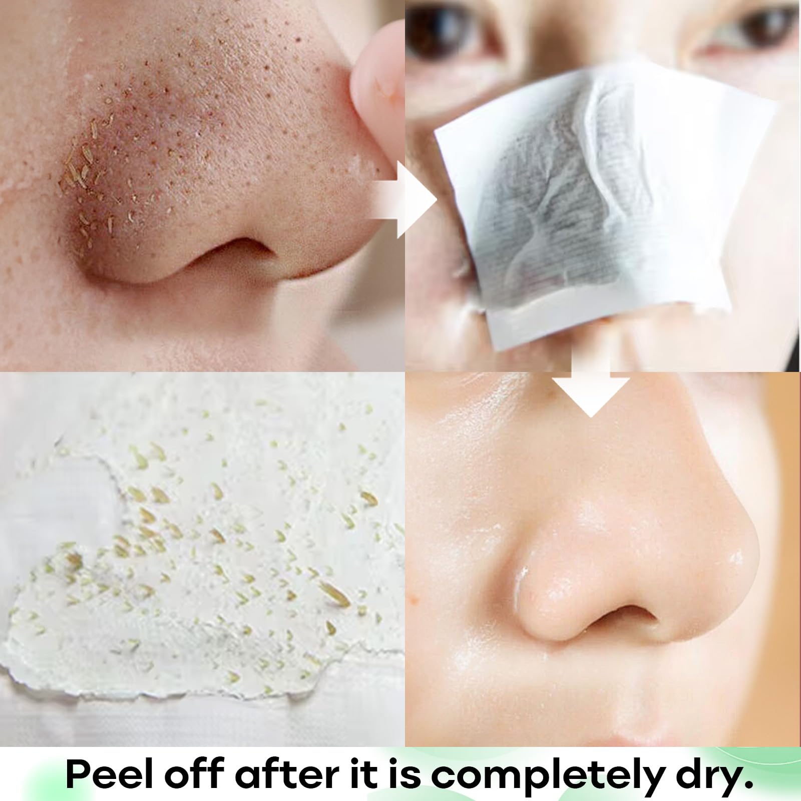 SYABO pore strips packaging with visible 100-strip supply benefit