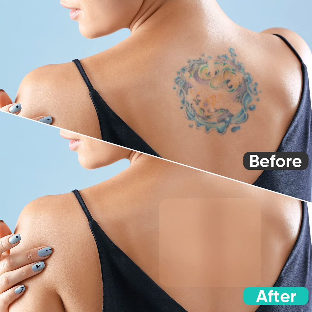 Tailverse patch on arm concealing tattoo for discreet appearance