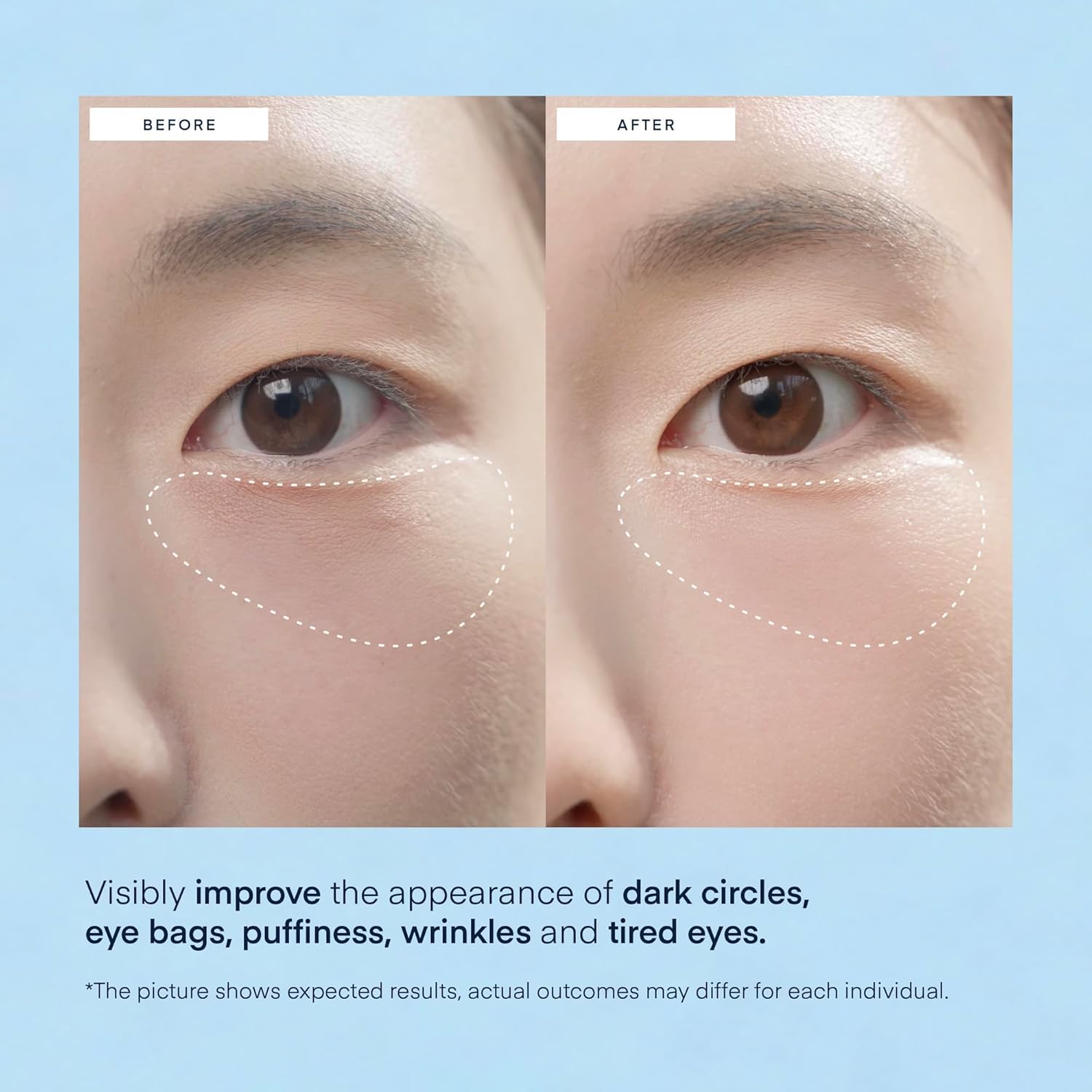 Terez & Honor caffeine ingredient highlight reducing puffiness