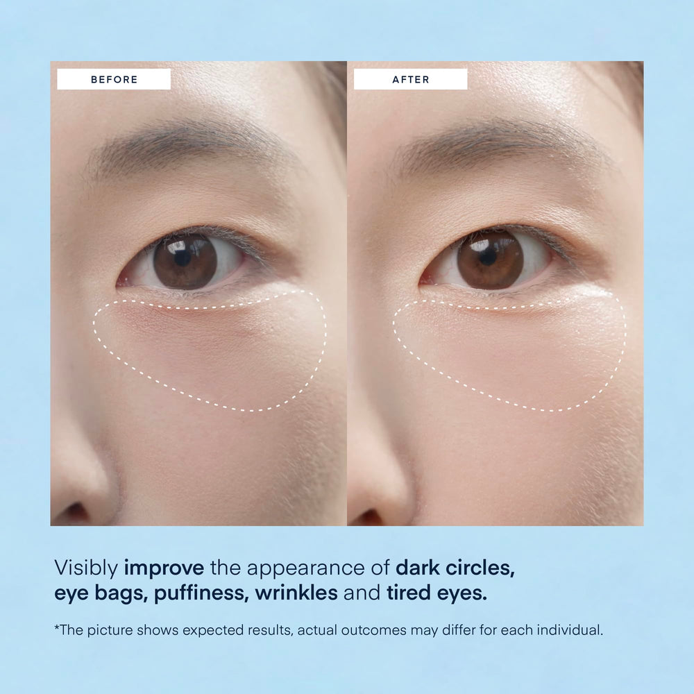 TEREZ & HONOR patch applied under eye demonstrating easy adhesion