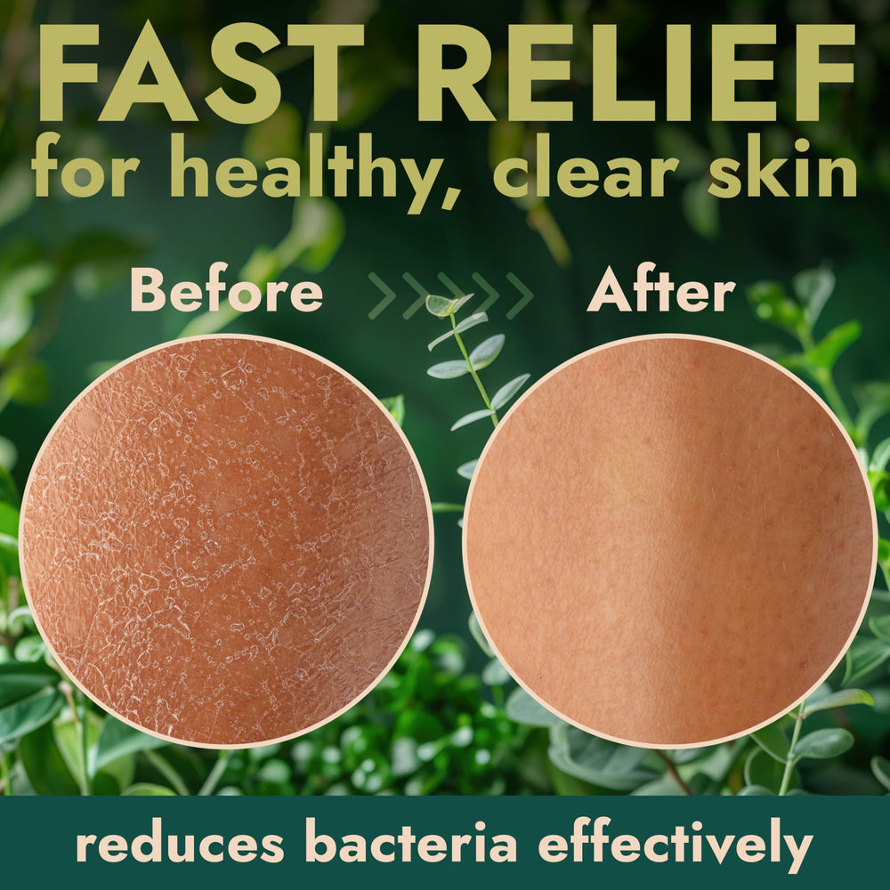 Terramed Just Think Comfort scrubber in hand cleaning back to unclog pores effectively