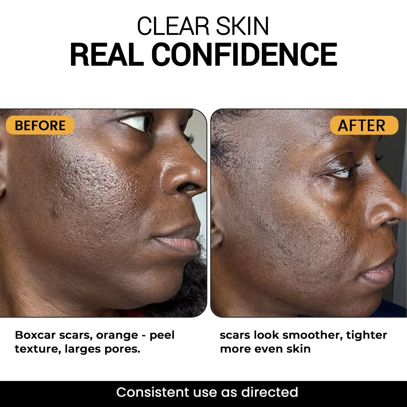THE DRM LAB before and after scale comparison illustrating improved skin texture
