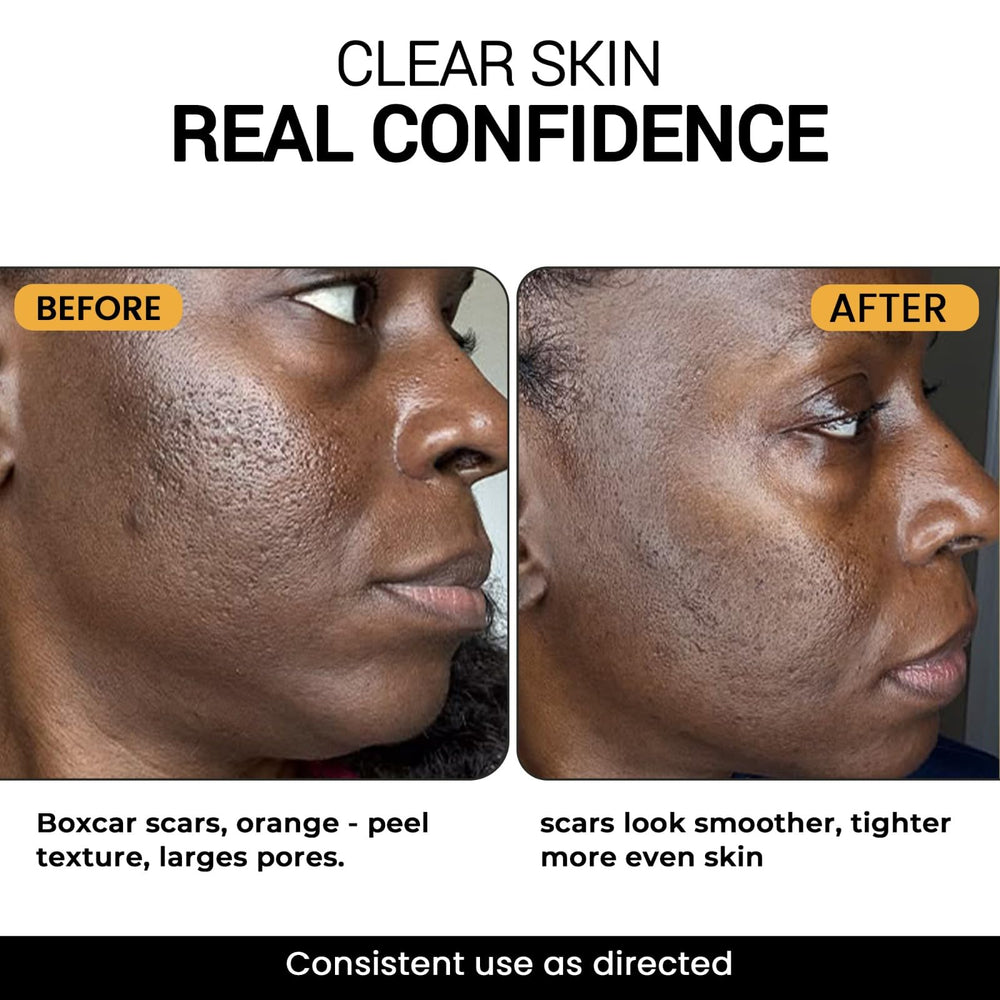 THE DRM LAB before and after scale comparison illustrating improved skin texture