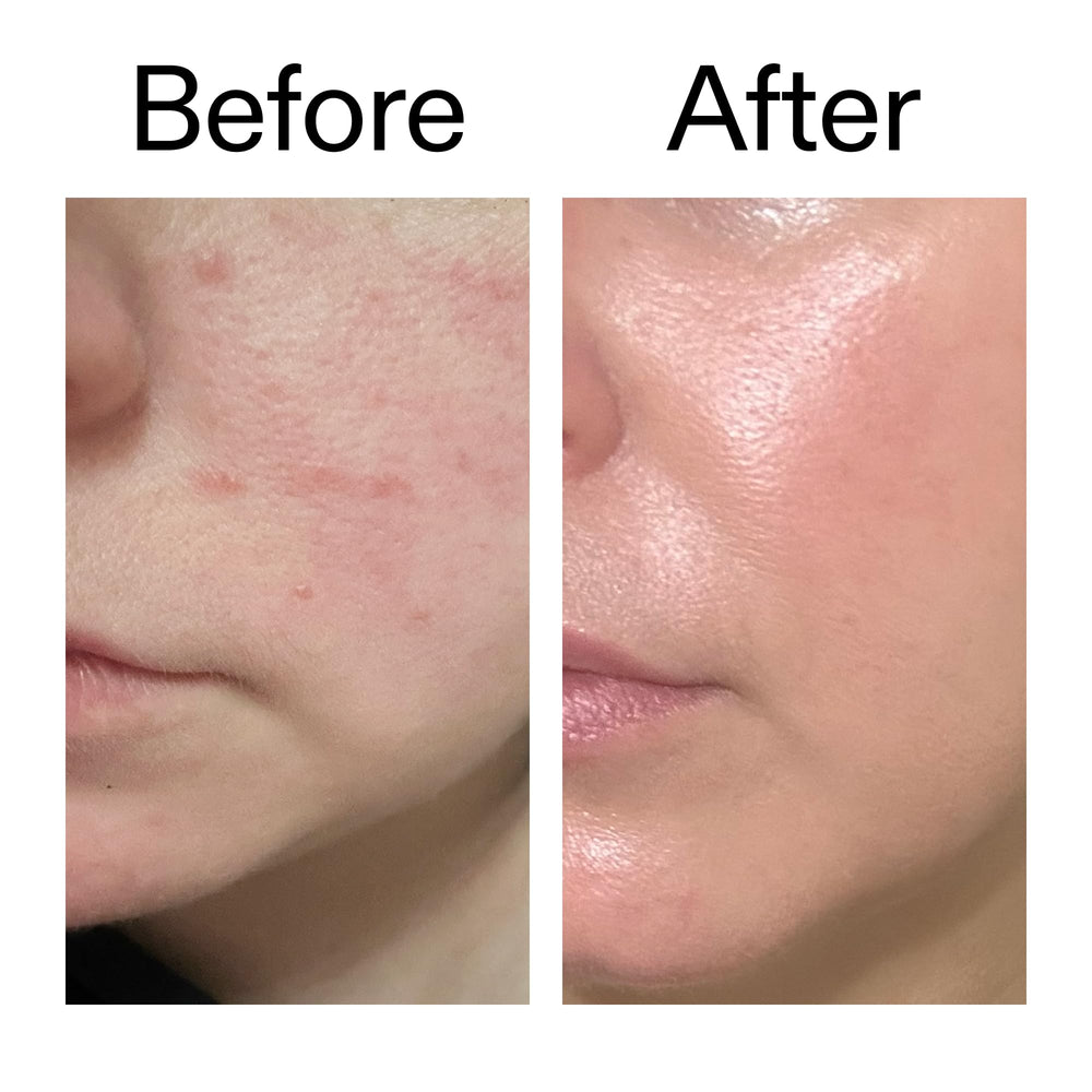 Morning routine application with serum under moisturizer for dewy, pre-makeup skin