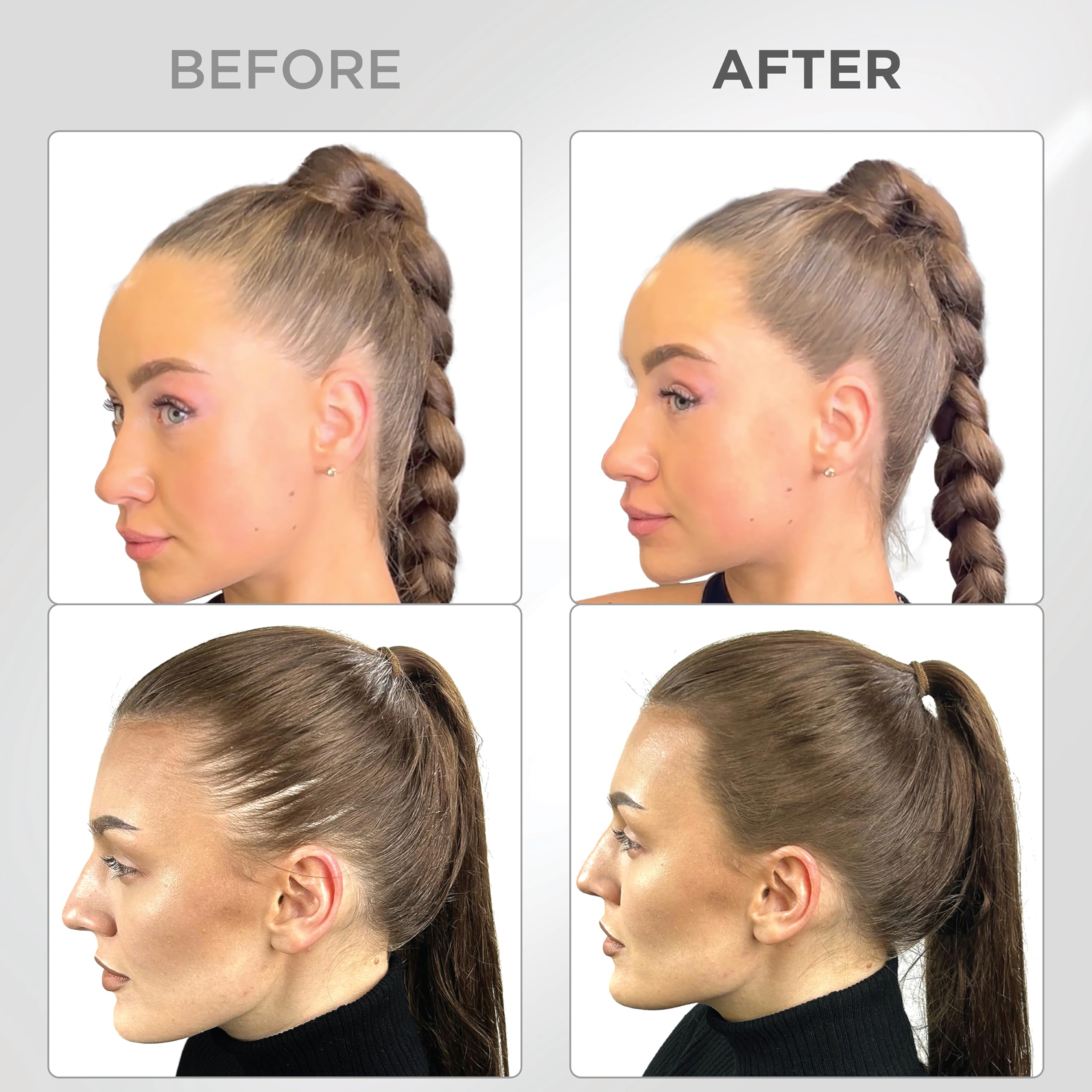 Thick Fiber application along part line creating blended gray root coverage