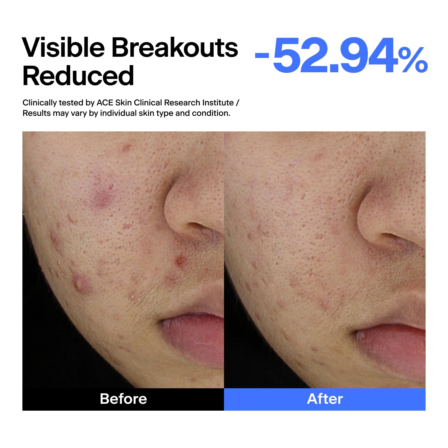 THOME applying a few drops to skin, showing quick absorption and mattifying effect