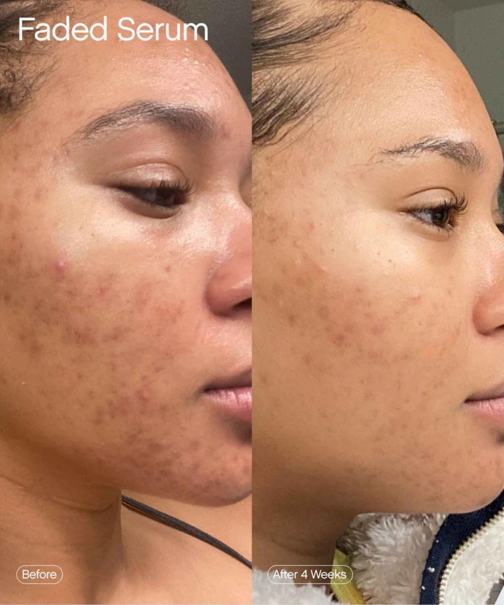 Topicals serum fully absorbed into skin revealing non-greasy finish and smoother look