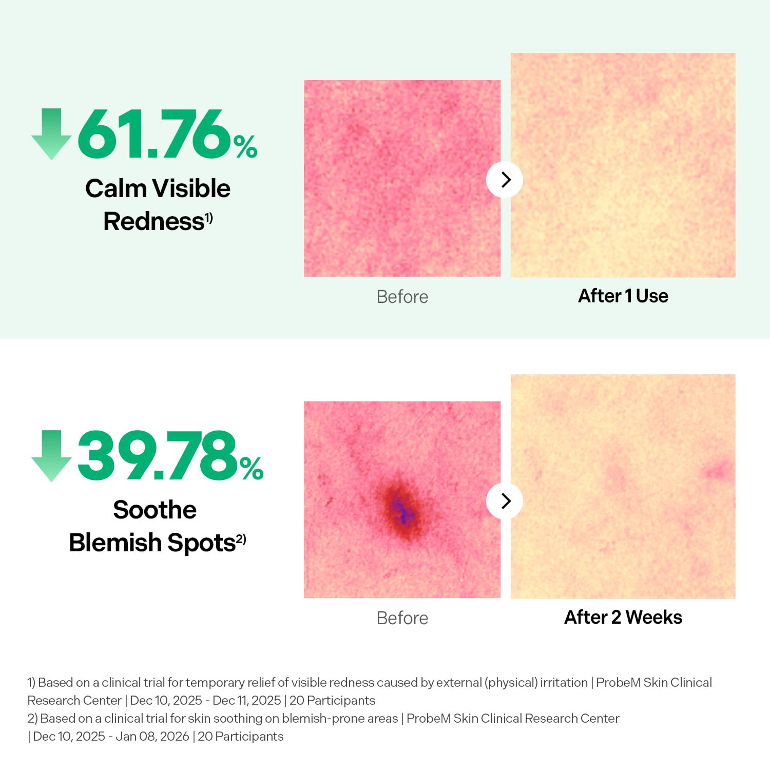 Torriden serum applied to cheek demonstrating calming and smoothing