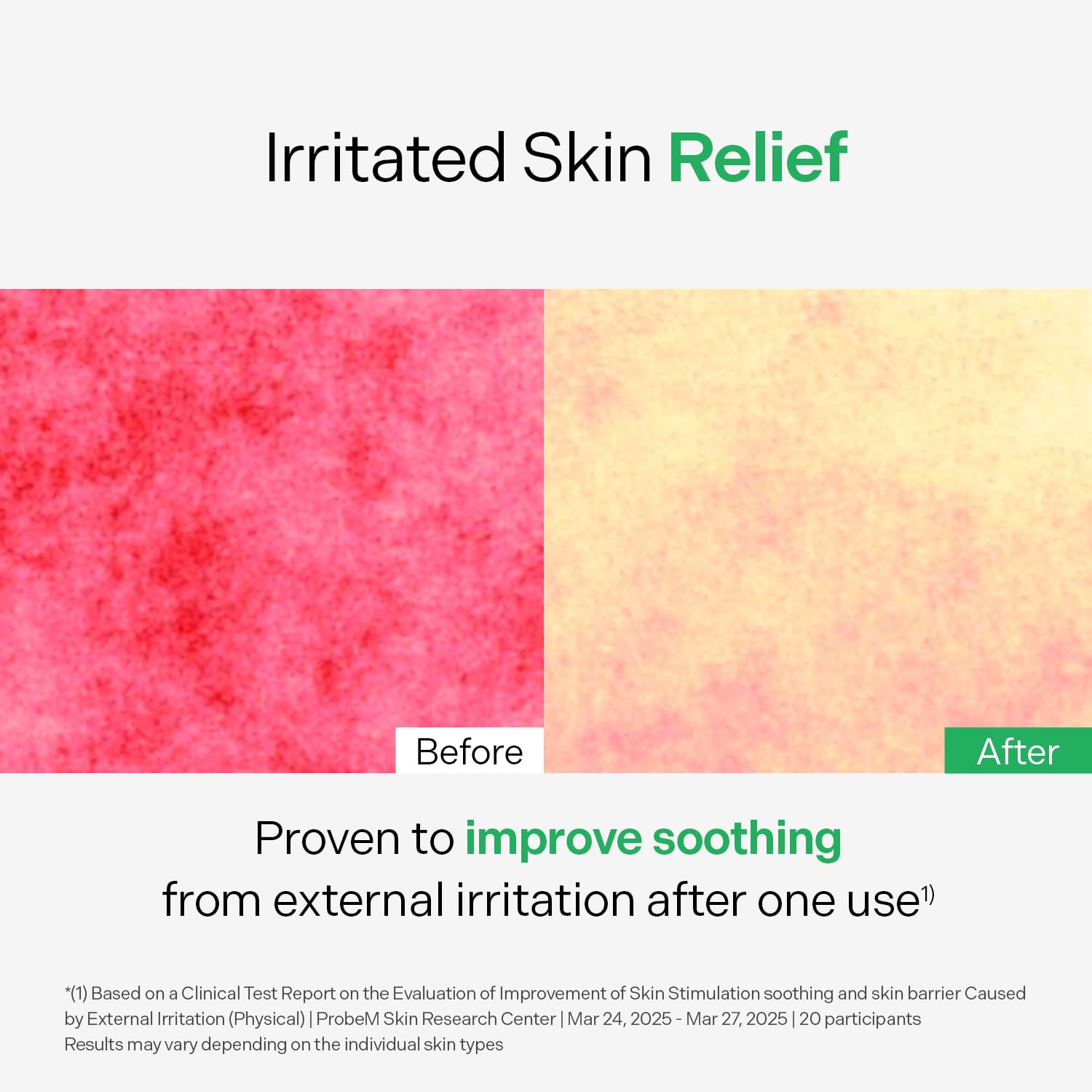 Applying Torriden serum on cheek, soothes redness and controls shine