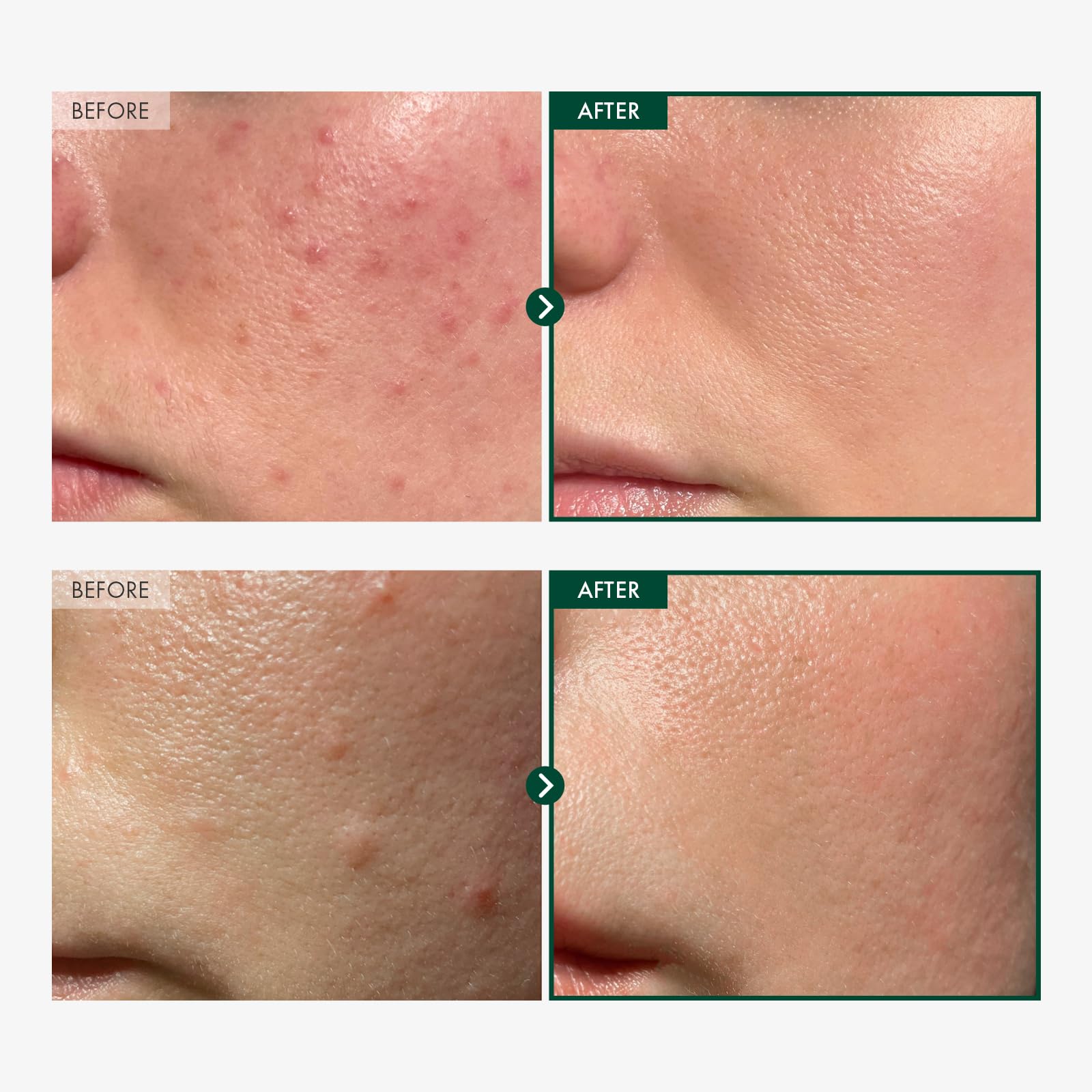 TOSOWOONG dropper dispensing serum highlighting precise application benefit