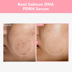 TOSOWOONG dropper dispensing serum showing lightweight texture and quick absorbency