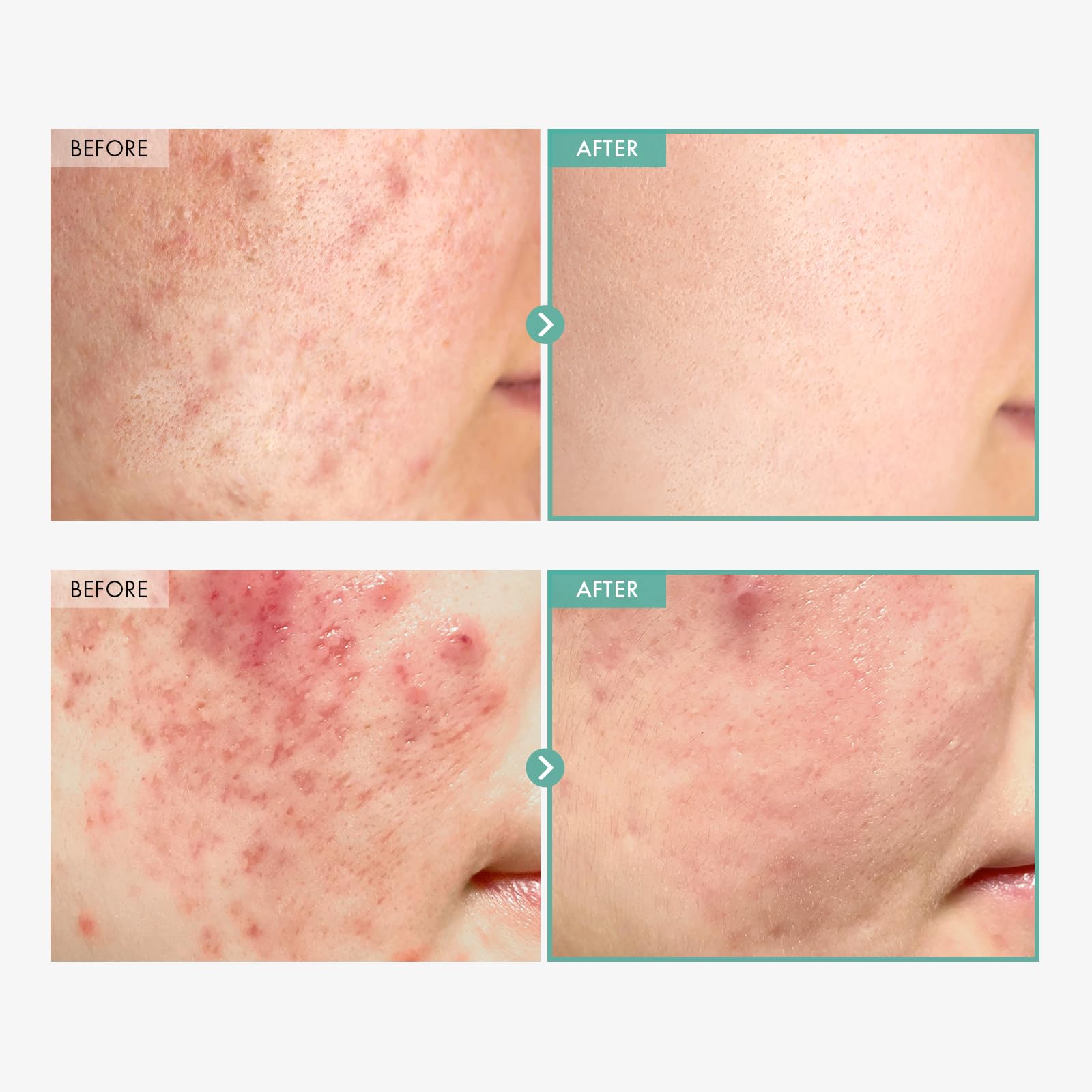 TOSOWOONG ingredient label closeup highlighting panthenol concentration benefit