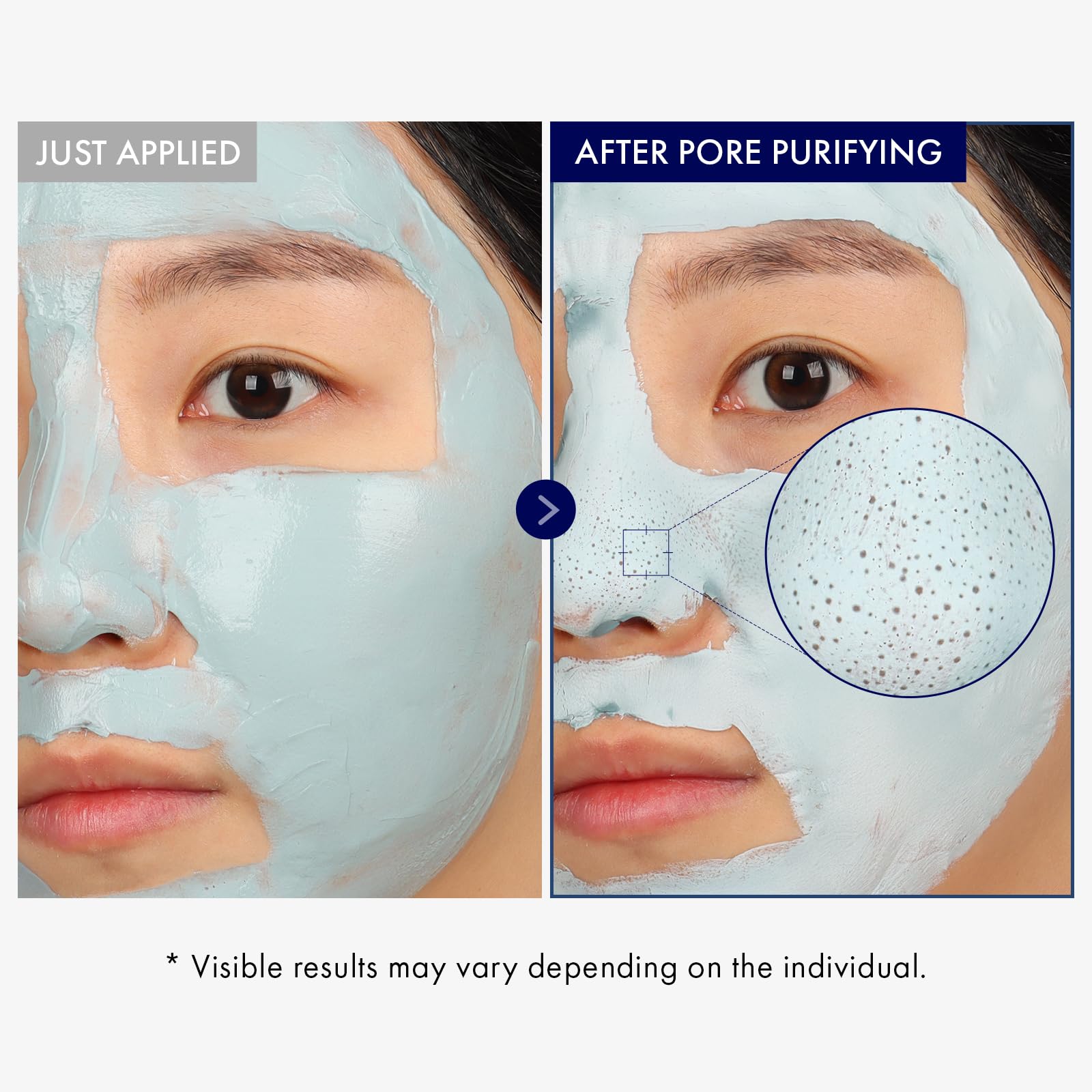 TOSOWOONG mask applied to nose area demonstrating blackhead-targeting effect