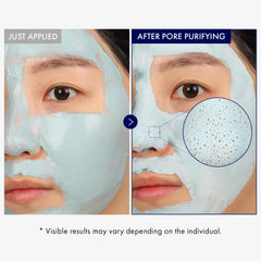 TOSOWOONG mask applied to nose area demonstrating blackhead-targeting effect