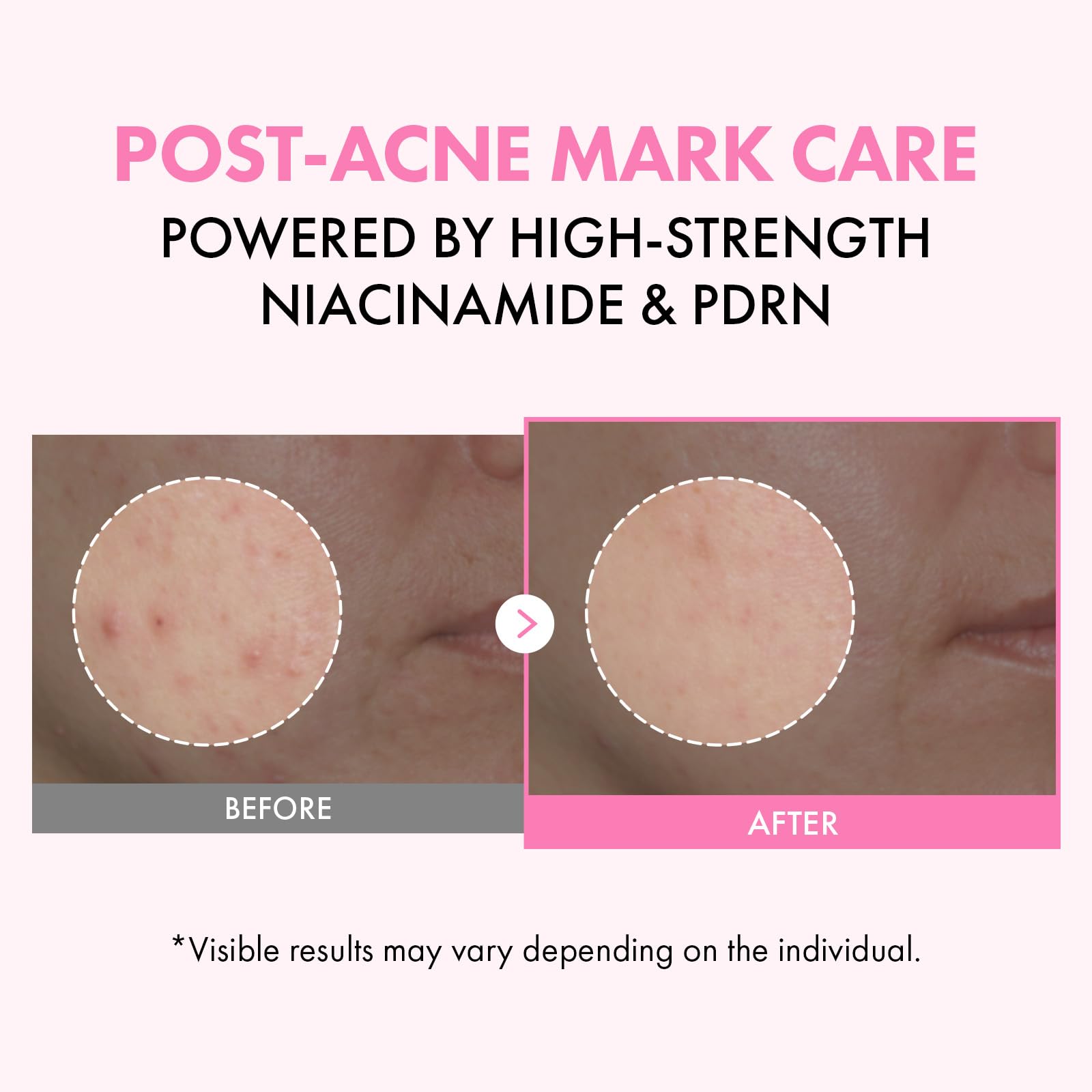 TOSOWOONG milky pink toner texture on palm demonstrating quick absorption