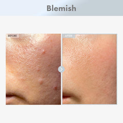 TOSOWOONG glass dropper dispensing serum, precise application benefit