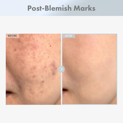 TOSOWOONG serum texture on hand illustrating lightweight absorbency