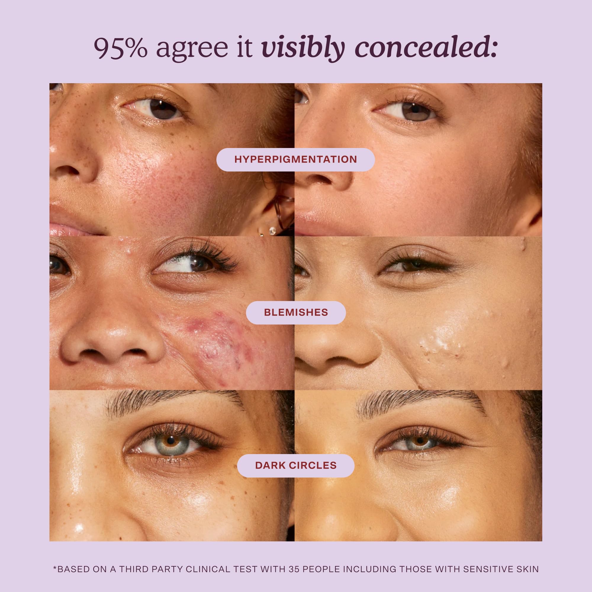 Tower 28 under-eye application demonstrating targeted coverage and brightening effect