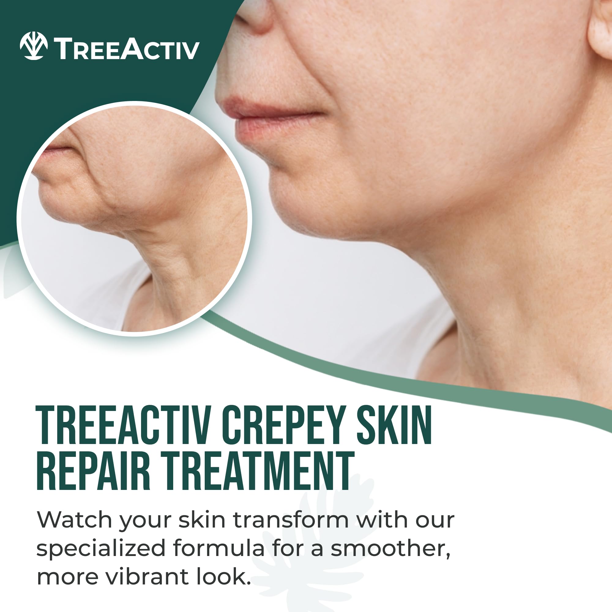 TreeActiv creamy texture close-up demonstrating rich hydration and smooth finish