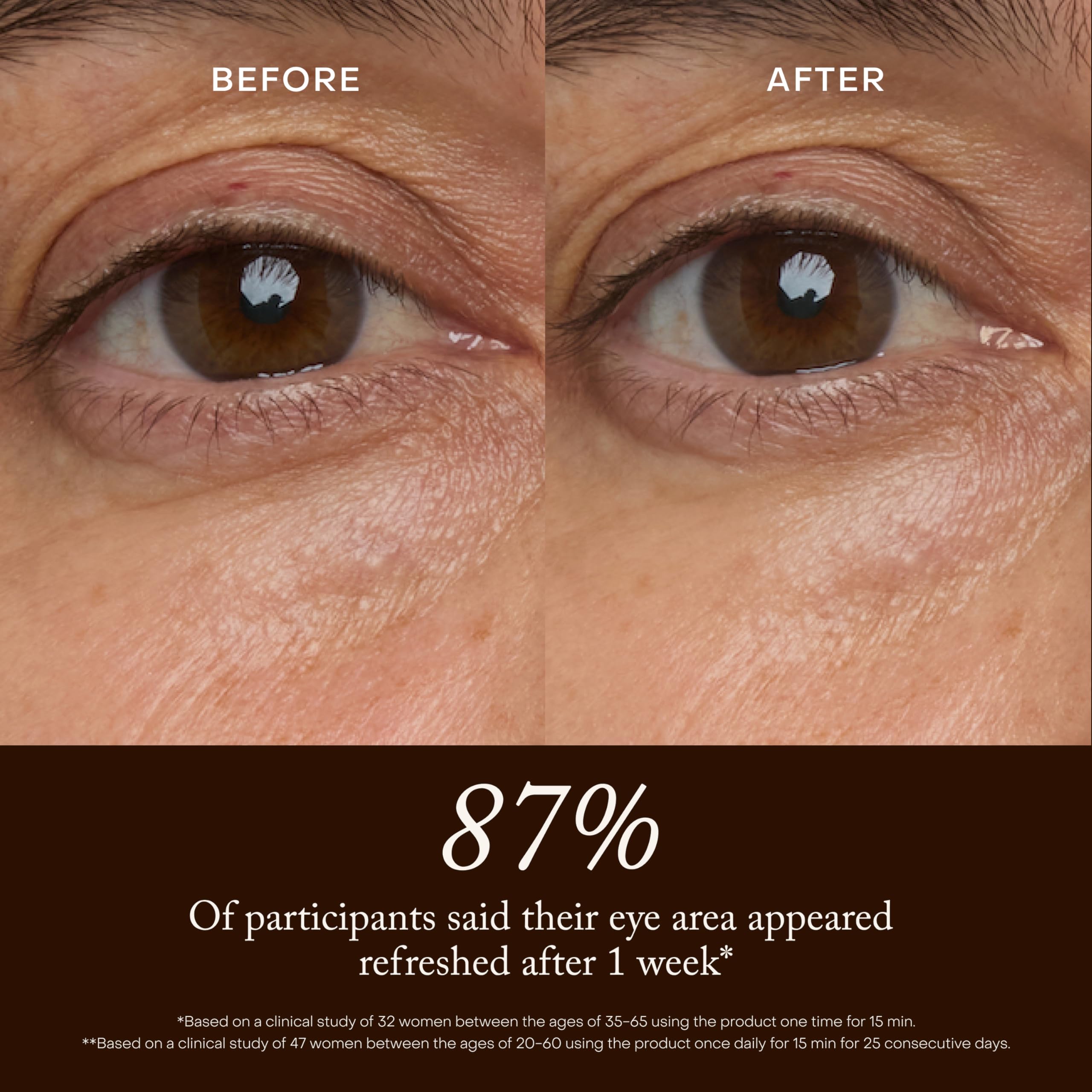 True Botanicals model applying patch under eye for instant de-puffing