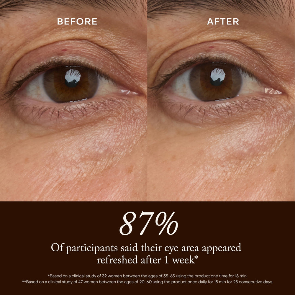 True Botanicals model applying patch under eye for instant de-puffing