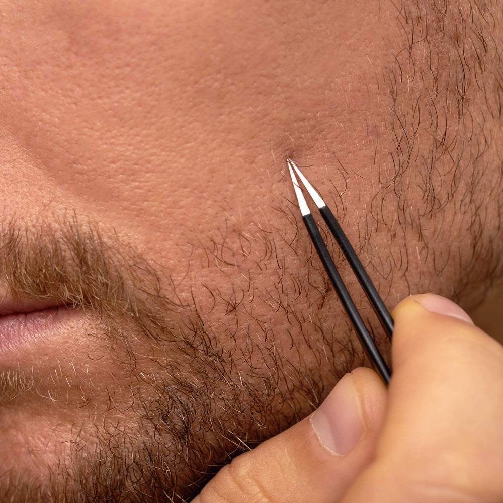 Tweezerman in use extracting a splinter from skin demonstrating controlled, precise removal
