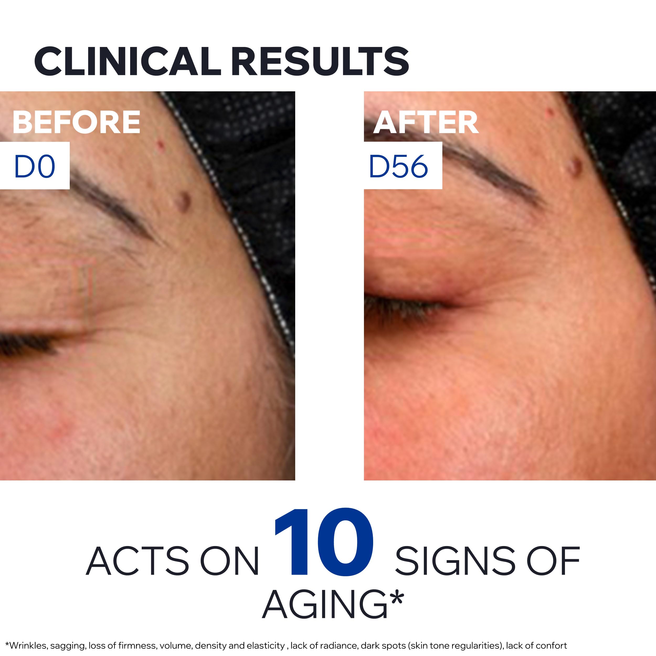 Uriage before and after visual illustrating improved density and radiance