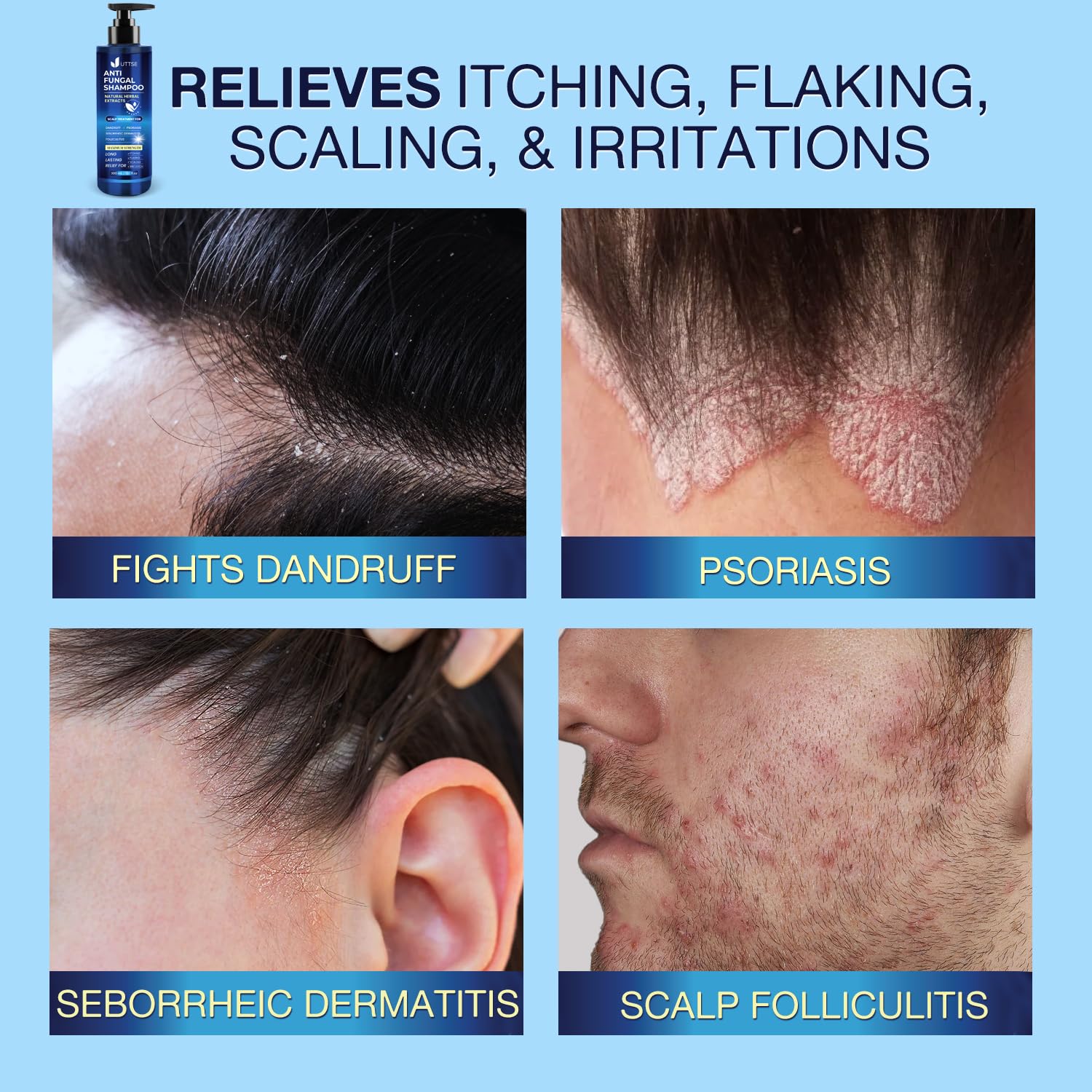 uttse closeup label emphasizing 1% salicylic acid ingredient clarity