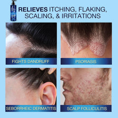 uttse closeup label emphasizing 1% salicylic acid ingredient clarity