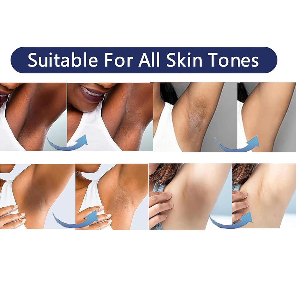 Vcetree used on bikini area to even tone and reduce dullness