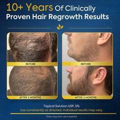 VeraRoot applying solution to cheek area to target patchy beard growth effectively