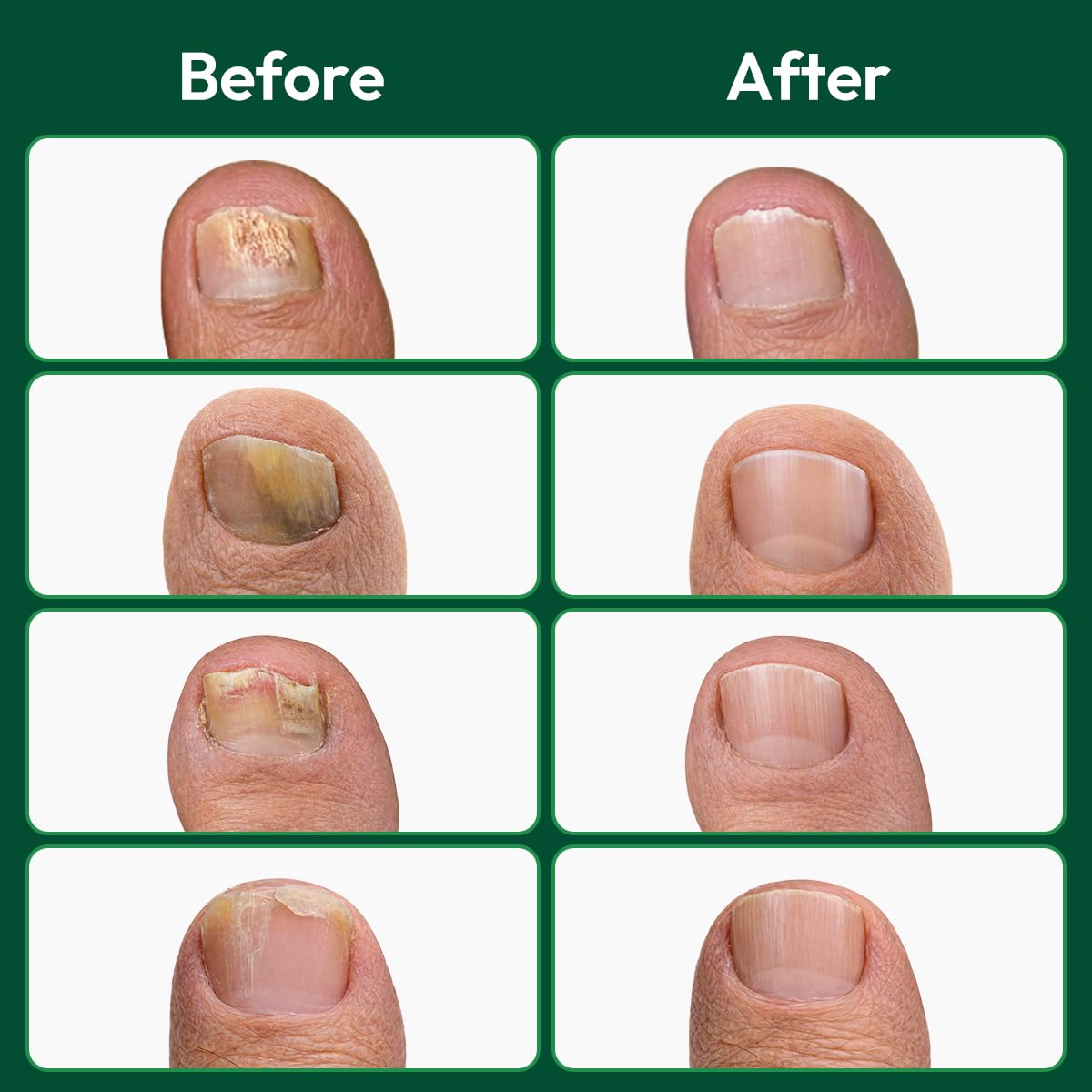 VERDORA hand holding patch to show size and easy application benefit